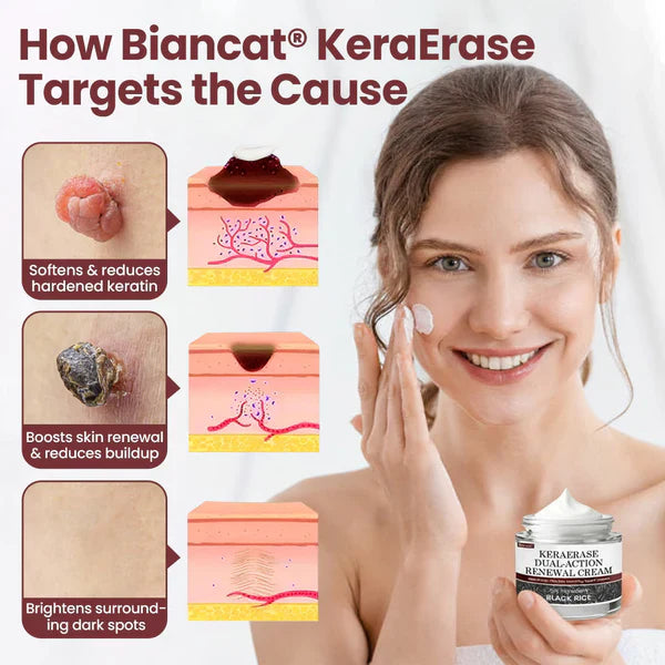 Biancat® KeraErase Dual-Action Renewal Cream