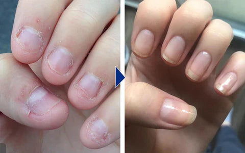 Biancat OnyxoGuard Nail Growth and Repair Serum