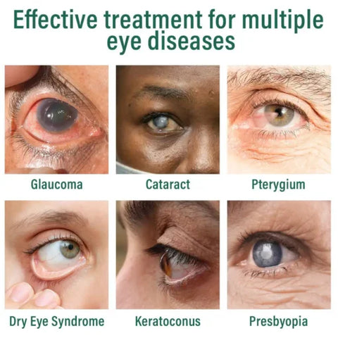 LOVILDS™ Nano Eye Drops Serum ( Made In USA )