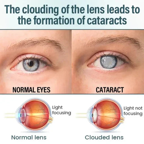 LOVILDS™ Nano Eye Drops Serum ( Made In USA )